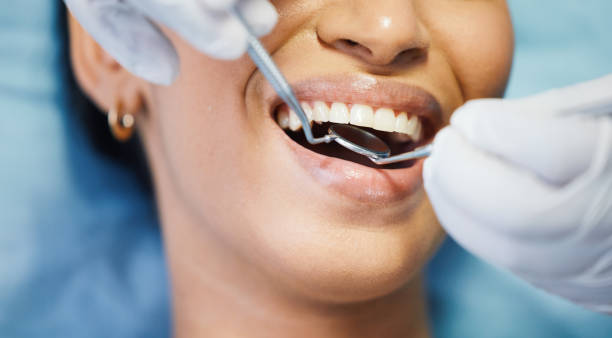 Best Emergency Tooth Extraction in Saratoga, WY