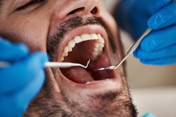 Fast & Reliable Emergency Dental Services in WY