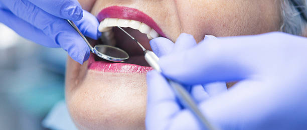 Best Emergency Treatment for Toothache in Saratoga, WY